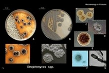 Streptomyces streptomycetes image